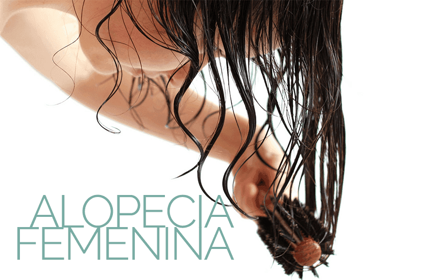 ¿Qué es Alopecia femenina?