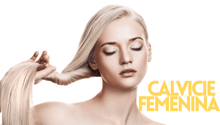 Calvicie femenina.