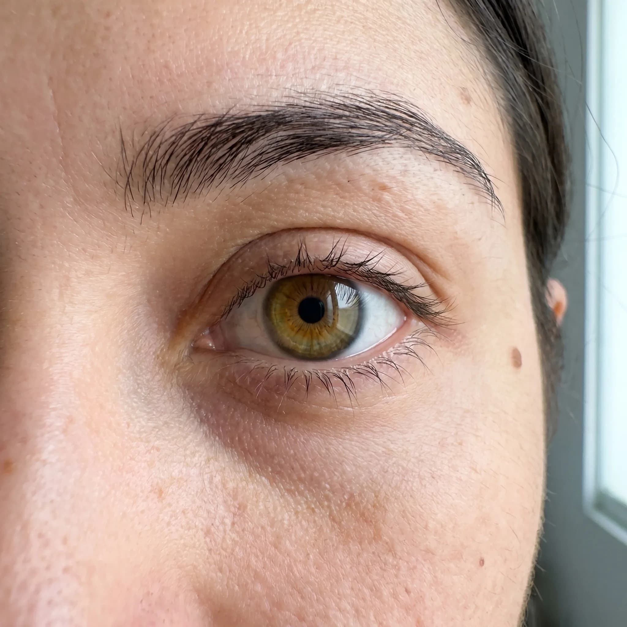 Antes