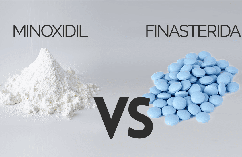 Minoxidil vs Finasterida: cuál es mejor para tu caída de cabello