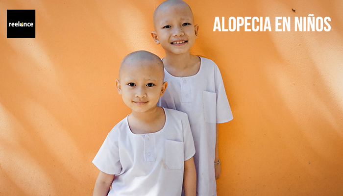 alopecia en ninos