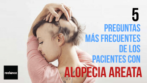 preguntas frecuentes pacientes alopecia areata