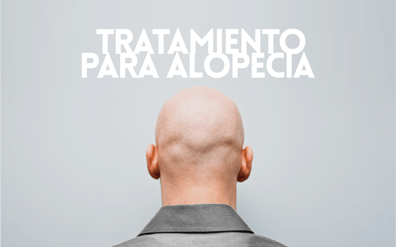tratamiento para alopecia 2
